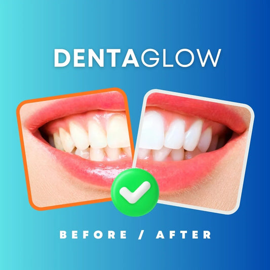 DentaGlow –  Teeth Whitening Gel