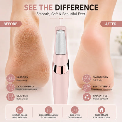Flawless Pedi Electric Callus Remover – Rechargeable Pedicure Tool Pakistan