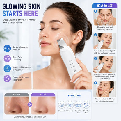 Leather Shovel Ultrasonic Facial Skin Scrubber – HandyPeak Blackhead Remover