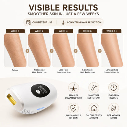 Professional IPL Hair Removal Device – Permanent Laser Hair Removal Machine | 999999 Flashes