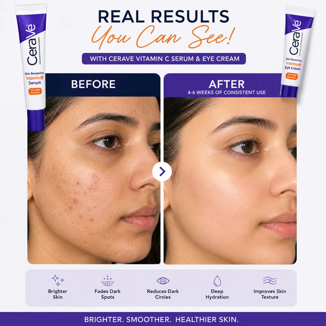 CeraVe Vitamin C Serum & Eye Cream